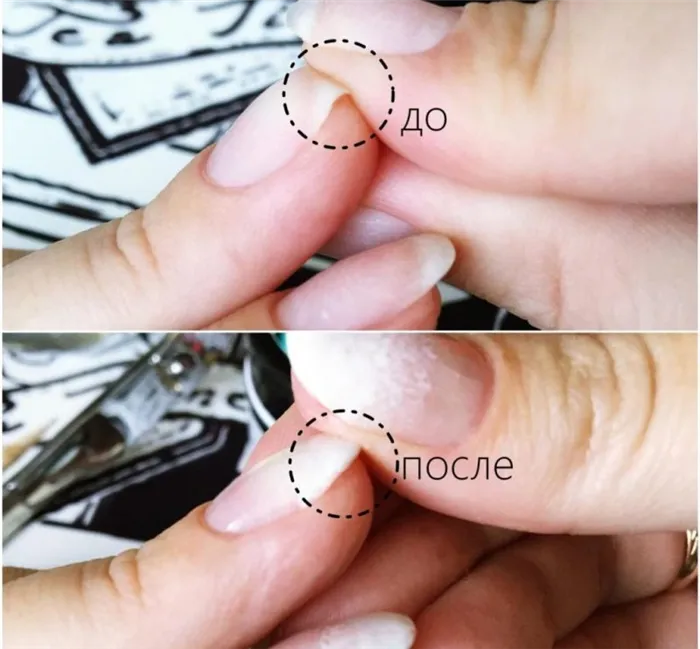 до и после укрепления